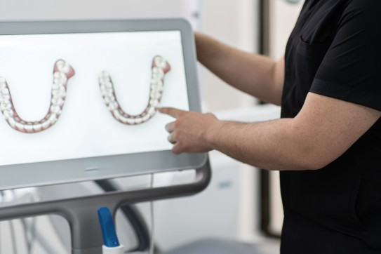 ZFA zeigt auf 3D Scan einer Zahnreihe